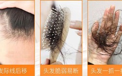 女人掉头发需要补什么，女人掉头发缺的6种营养