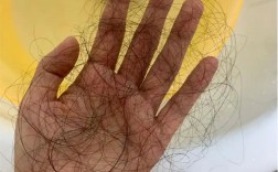 头发掉的很严重是什么原因，常见8个严重脱发的原因